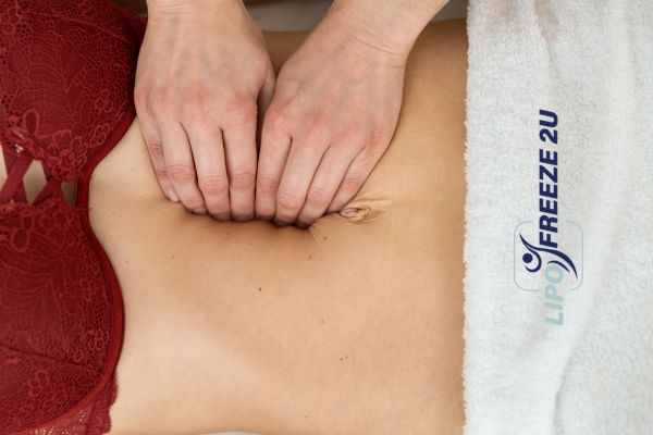 diastasis recti treatment Farnham