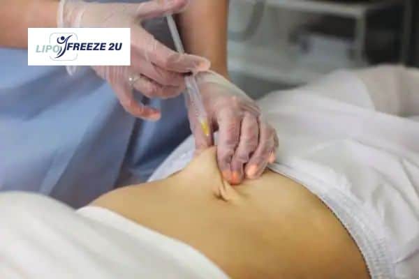 Fat Dissolving Injections Farnham & Weight loss medication