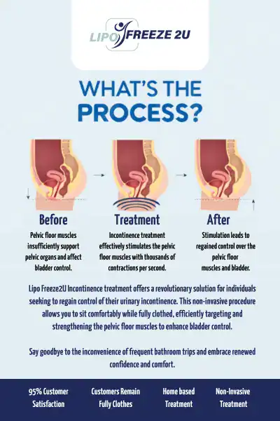 Diagram of how incontinence treatment Farnham works.