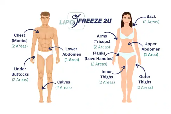 Areas you can have fat freezing treatment Farnham