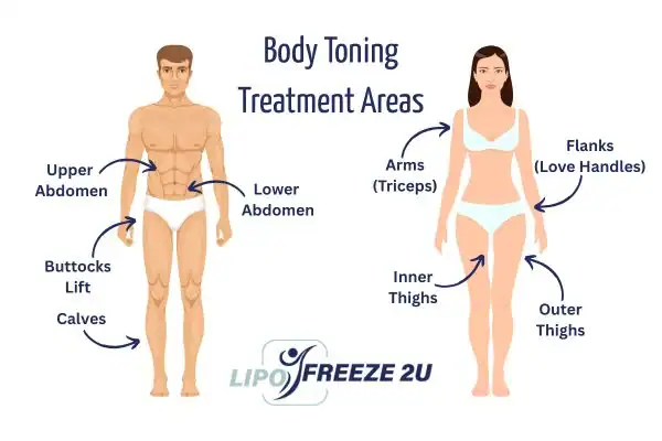 Graphic showing where you can have Body toning Treatment Farnham on your body