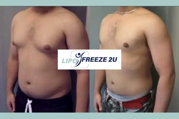 How Long Does It Take to See Results Farnham?
