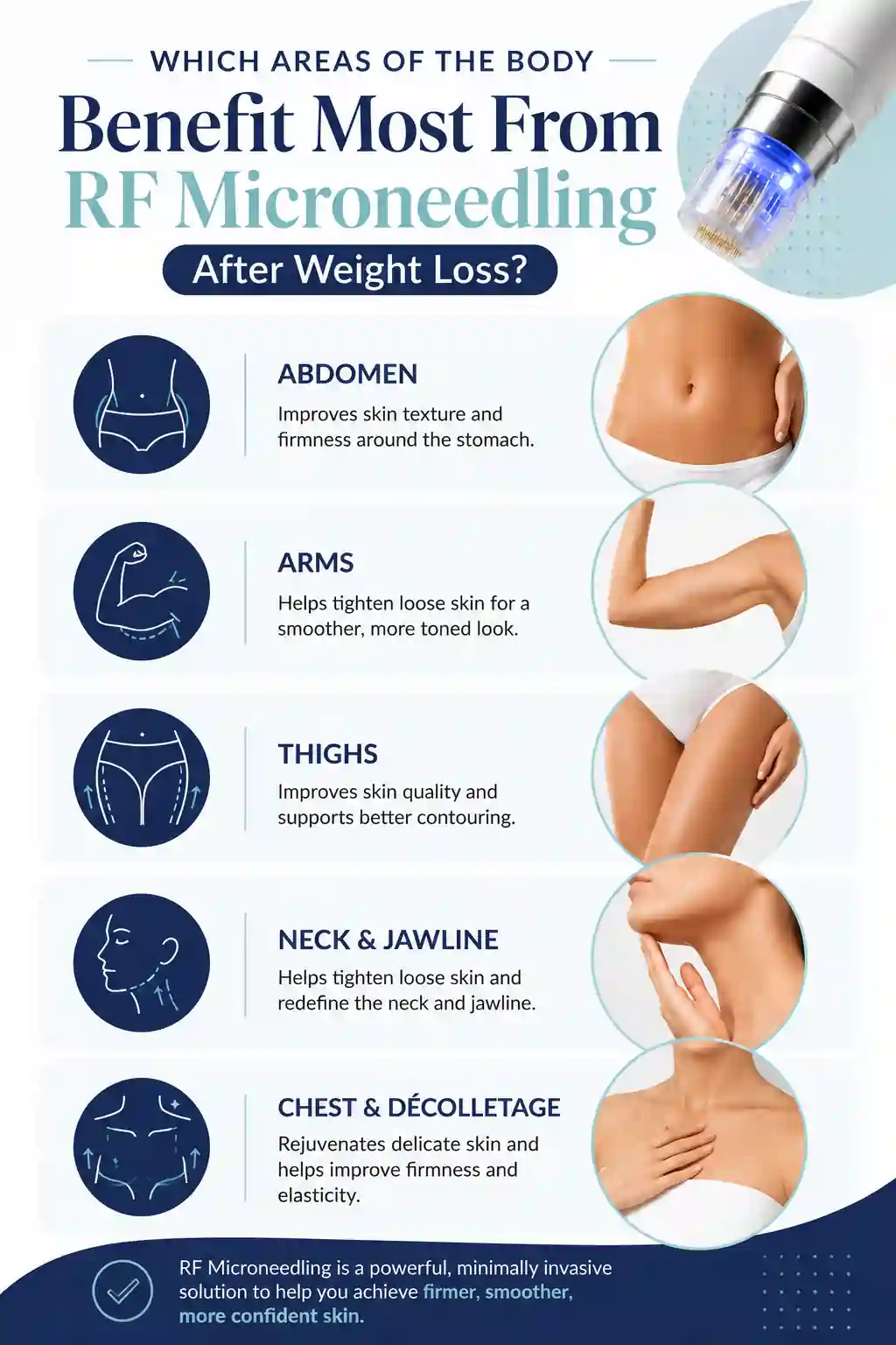 Which Areas of the Body Benefit Most From RF Microneedling After Weight Loss Farnham